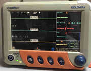 Goldway UT4000Apro 12.1 İnç TFT Ekranlı Hasta Monitörü Kullanıldı